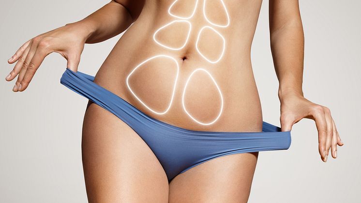 It is now scientifically proven that combining liposuction and exercise therapy contributes to a plethora of health benefits, including reducing cardiovascular risks.