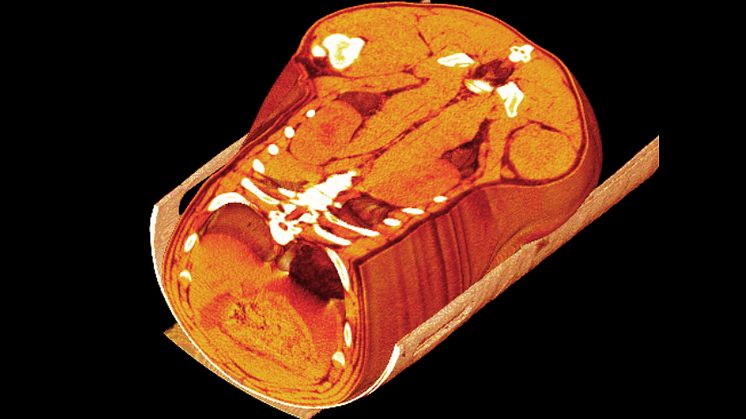 CT 3D