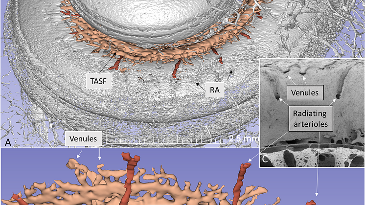 Cochlea blood vessel canals
