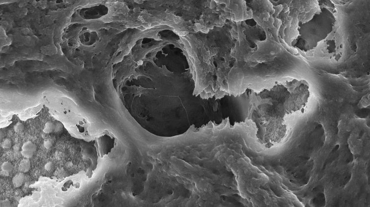 Imaging bone surfaces with electron microscopy.