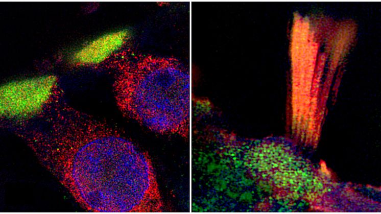 Proteins associated with hearing loss