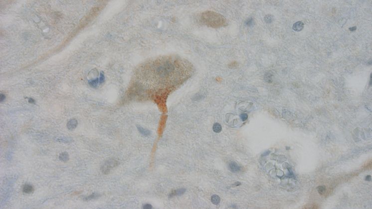 Felveckat protein