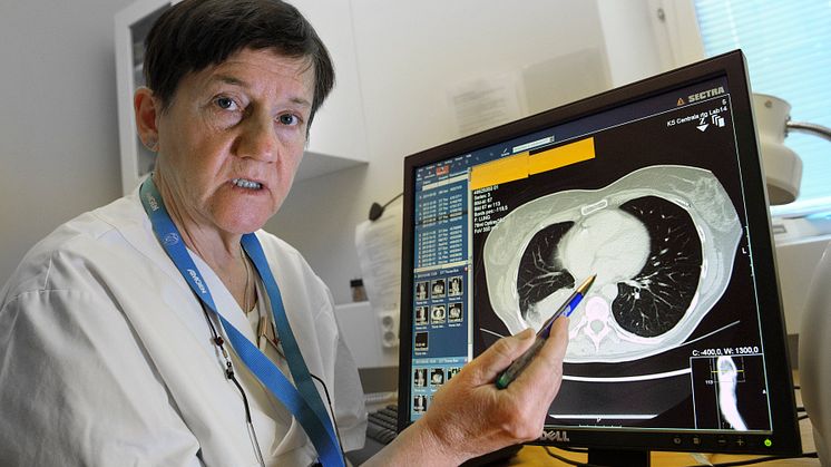 BRO i ny stor satsning om spridd bröstcancer – vill tala om det svåra