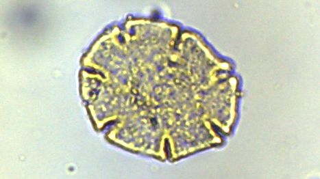 pollen sample.jpg