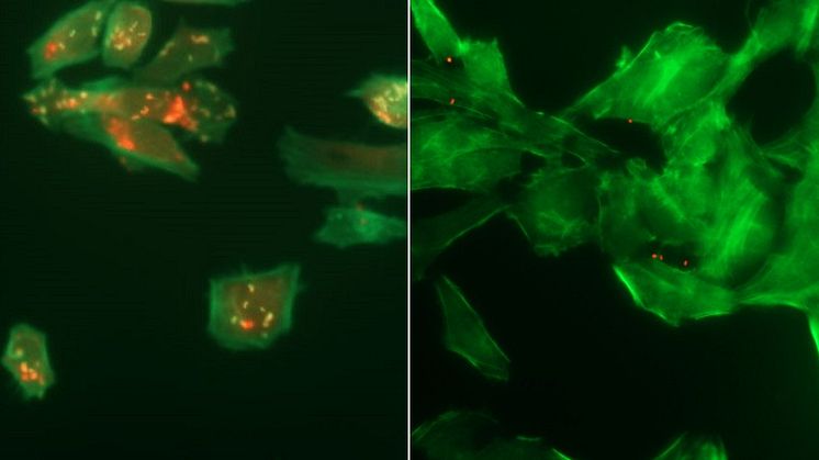 Nyupptäckta kemiska substanser kan verka mot Listeria-infektioner
