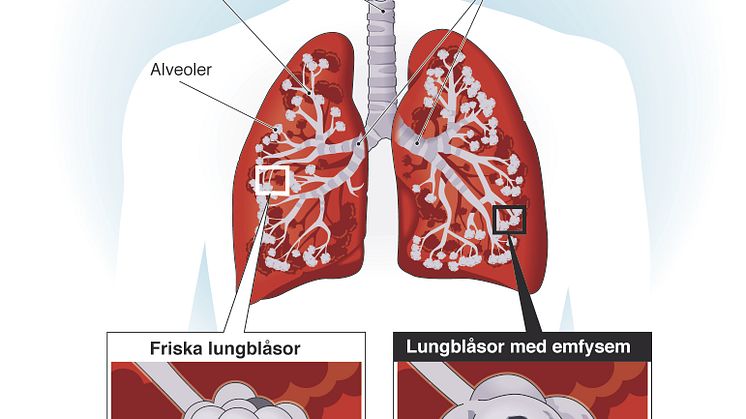 Illustration av KOL