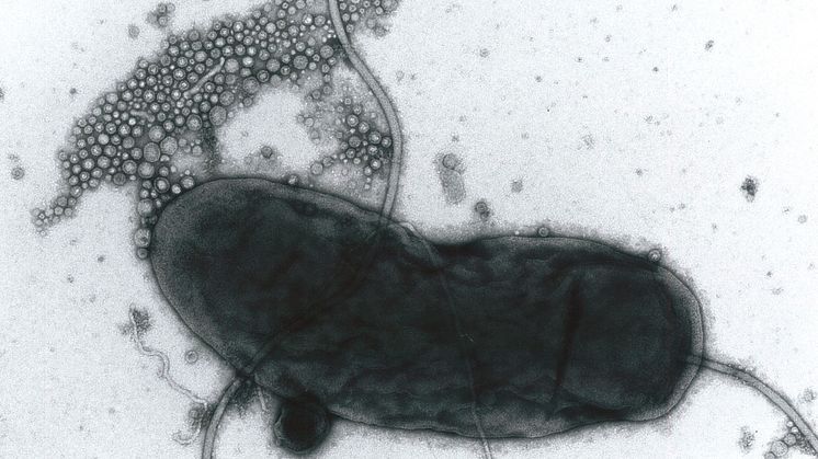Kolerabakterier Vibrio cholerae utsöndrar membranevesiklar (membranpartiklar). Foto: Akemi Takade, Kyushu University, Japan.