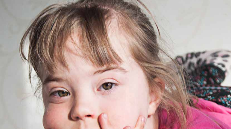 Autism och ADHD vid Downs syndrom