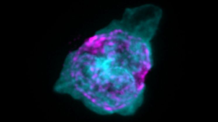 Vit blodkropp (magenta) som släpper ut NET-liknande strukturer (cyan). Immuncellen isolerades från en mus med CCM (cerebral cavernous malformation). Bild: Maria A. Globisch