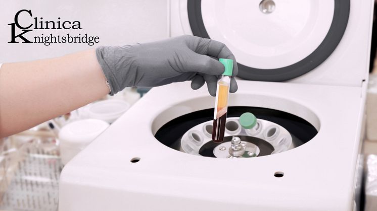 clinica_knightsbridge_PRP_treatment