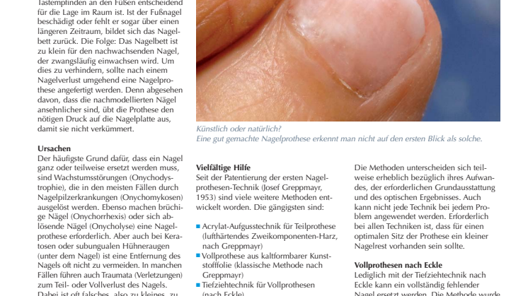 Nagelprothetik und Nagelersatz: Nicht nur für die Optik, sondern vor allem zum Schutz