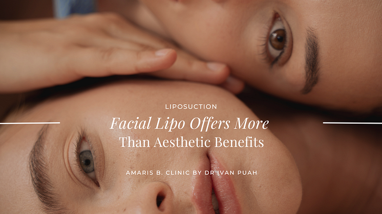 Facial Liposuction Offers More Than Aesthetic Benefits