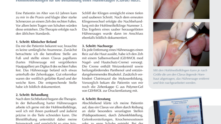 Instrumente im Einsatz: Sauberer Schnitt - die Hohlmeißelklinge