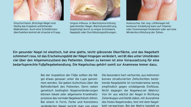 Die Biographie eines Nagels