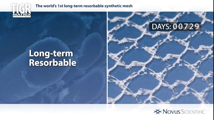 TIGR® Matrix Surgical Mesh 