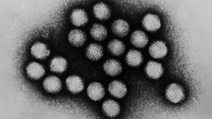 Adenovirus (Foto: Wikipedia)