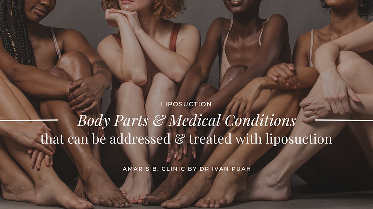 Body Parts & Medical Conditions that can be addressed & treated with liposuction | Amaris B. Clinic