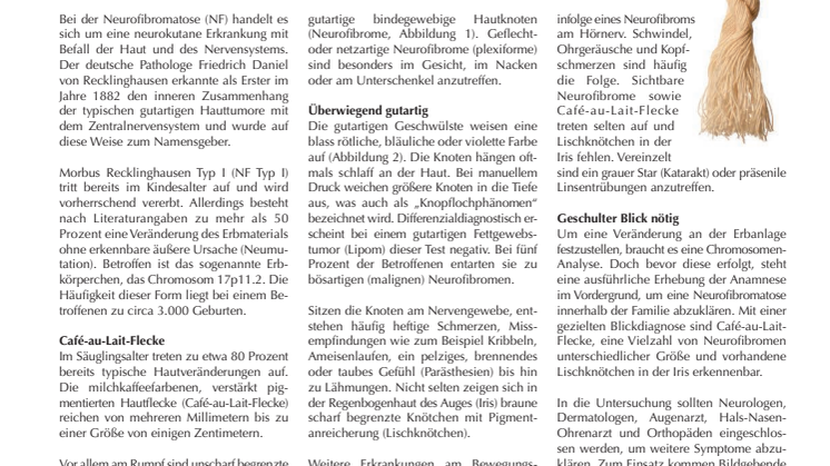 Neurofibromatose (Morbus Recklinghausen): Knoten in der Haut