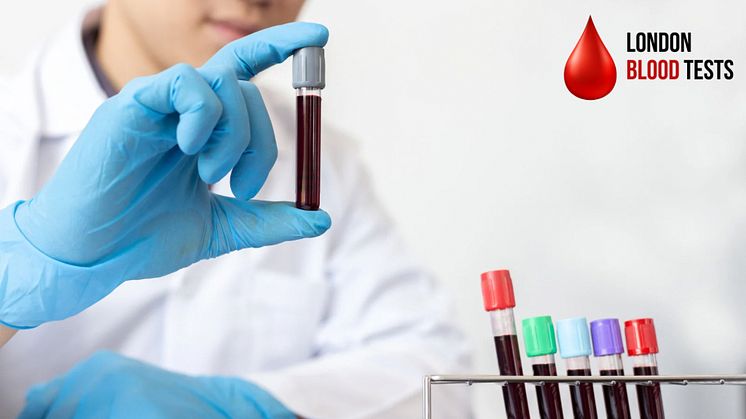 London Blood Tests - The Vital Importance of Regular Blood Tests in Detecting Cancer and Monitoring Health