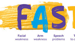 Rise in number of middle aged people having strokes - Stroke Association comments