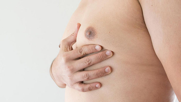 Gynecomastia & Pseudogynecomastia Differences