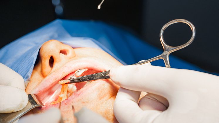Dr Ivan Puah Explains Major Differences Between Buccal Fat Removal And Cheek Liposuction Results