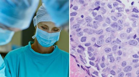 Iscaff Pharma - ny plattform för cancerdiagnostik och test av läkemedel