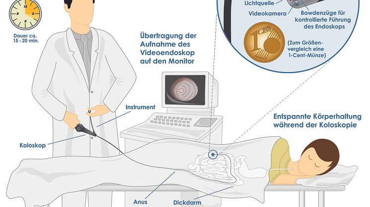 Darmspiegelung/Koloskopie des Dickdarms