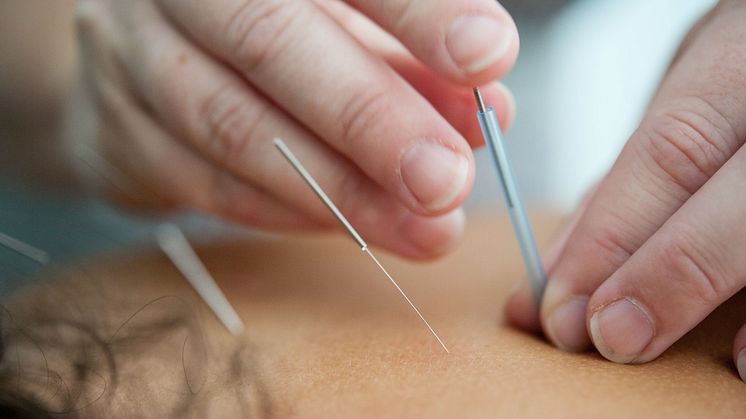Akupunktur behandling og dets potentiale