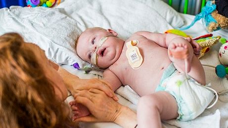 The PSE can analyse data and predict when a child’s condition may be deteriorating, providing an early warning system that can be acted on immediately