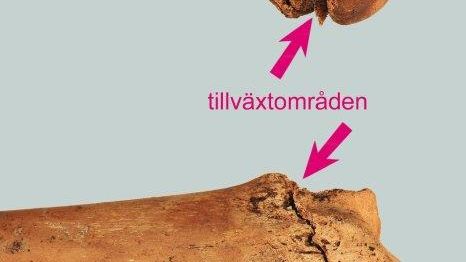 Bilden visar två av Hallonflickans ben på Falköpings museum. Hon levde för 5000 år sedan. Kan vi säga något om hennes ålder?