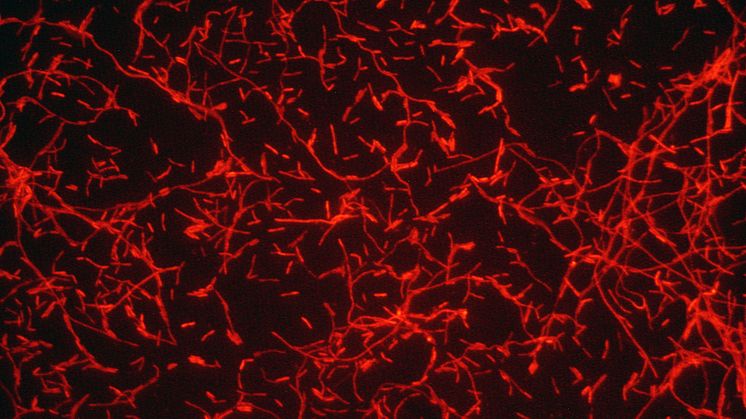 Innan sommaren lanserades projektet ”Stoppa Legionella”, den första informationsportalen på nätet med samlad information om bakterien och sjukdomarna som den orsakar, www.stoppalegionalla.se.