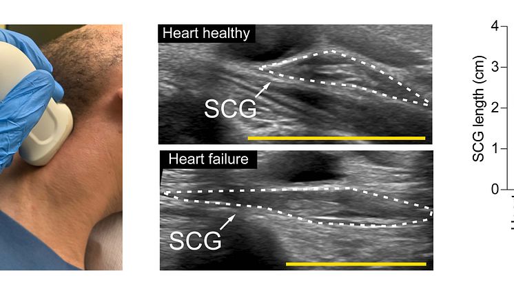 Abbildungen_Dr-Ziegeler_SCG_Ultrasound_Neu