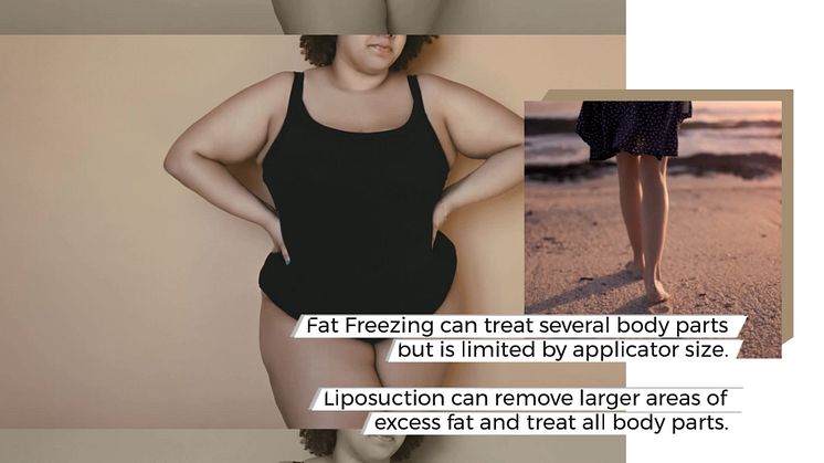 Fat Freeze versus Liposuction