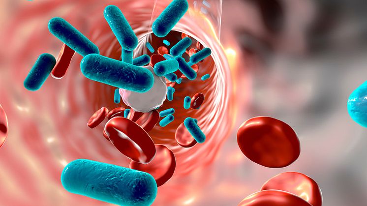 Patient monitoring system detects early signs of sepsis