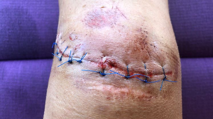 Hi-res: Karma Forester's injury