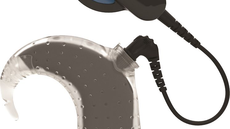 Cochlear_Aqua+_frontal