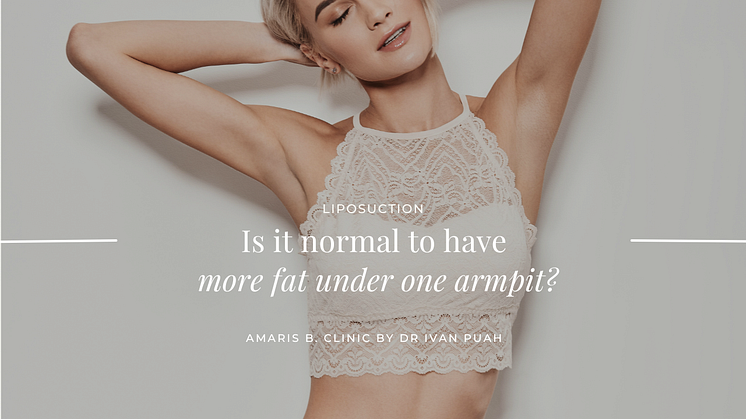 Is it normal to have more fat under one armpit? | Amaris B. Clinic by Dr Ivan Puah