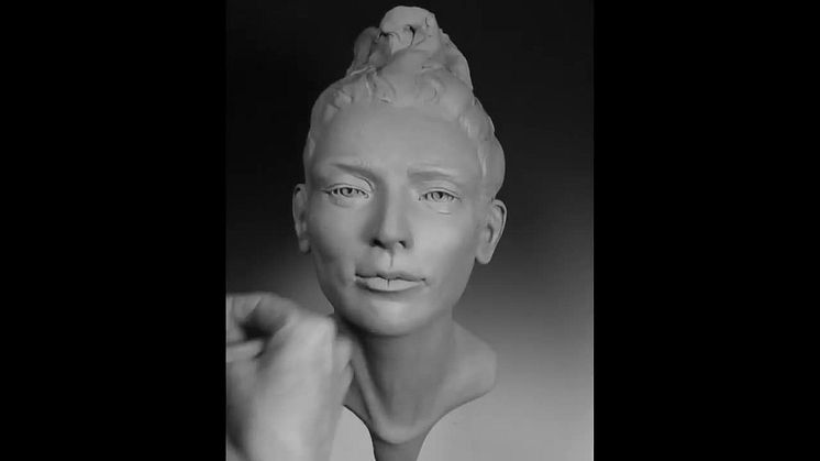[Ultherapy] The Aging Face