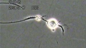 film_hörselnerv