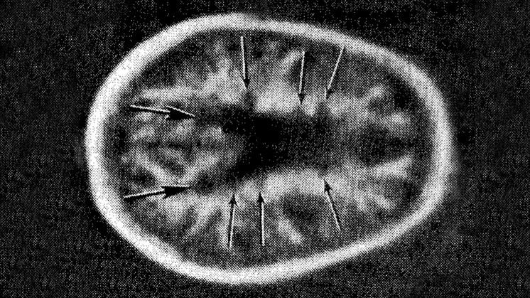 Young-MRI-MS-1981_fig5