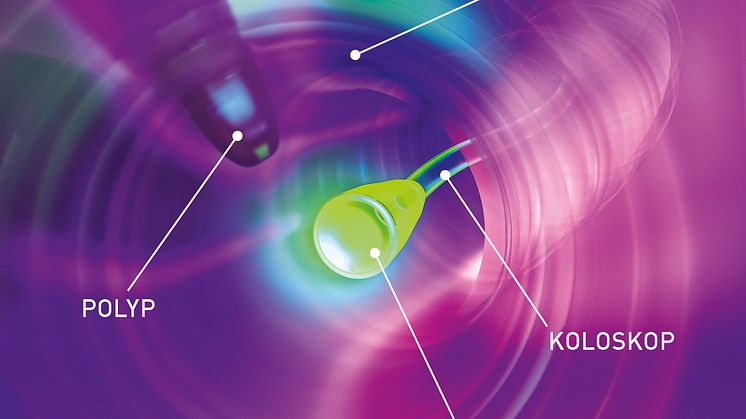 Die Vorsorge-Darmspiegelung wird 15 Jahre alt.