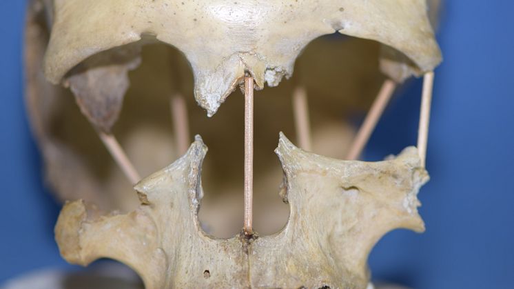 The skull of Peştera Muierii 1, which entire genome is now successfully sequenced. Photo: Mattias Jakobsson