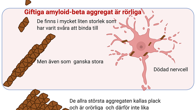 Alzheimers sjukdom