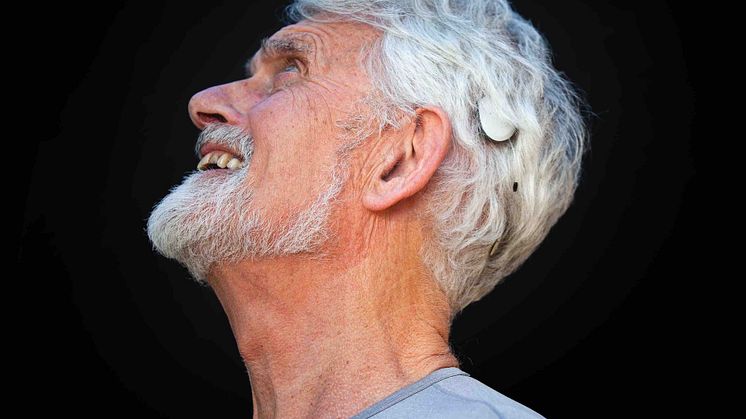 Hat sich mittlerweile vielfach in der Versorgung schwerhöriger Menschen bewährt – das CochlearTM Osia® System (Foto: Cochlear Ltd.)