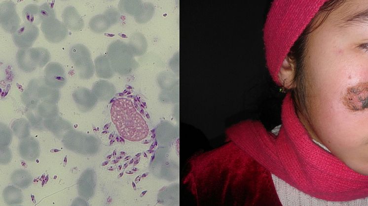 Bioforschung an der TH Wildau vs. Ausbreitung von Tropenkrankheit