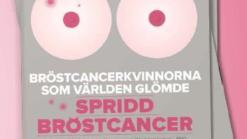 Ojämlik vård av kvinnor med spridd bröstcancer