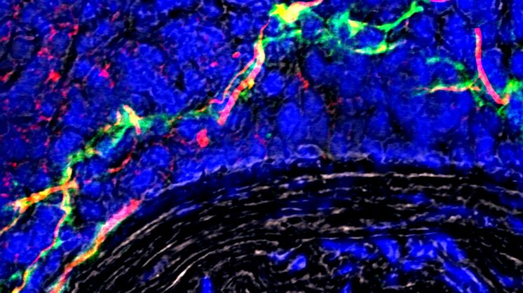 Aufnahme_Wachsendes-Nervennetzwerk-in-betroffener-Arterie_LMU-Klinikum