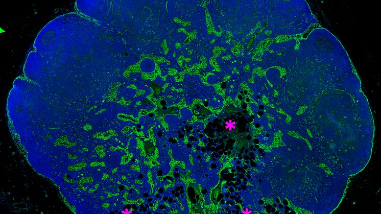 Immunofluorescensfärgning av en human lymfkörtel med tidig lipomatos (fett) lokaliserad till medullära delen av lymfkörteln. Bild: Tove Bekkhus 