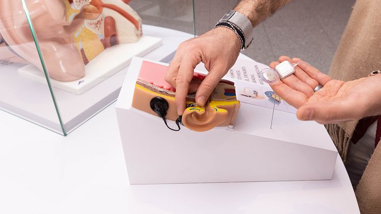 Gehirn und elektrisch stimuliertes Hören – auch neueste Hörimplantate von Cochlear werden in der Ausstellung vorgestellt (Foto: Bundeskunsthalle)